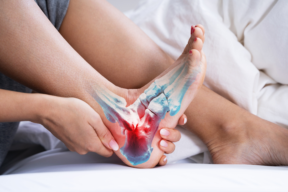 Le talus astragale : anatomie, pathologies, soins et traitements
